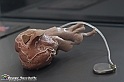 VBS_2884 - Cuore con Pacemaker - Mostra Body Worlds